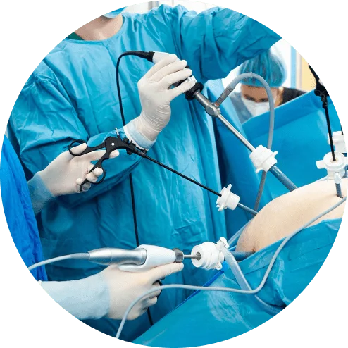 cirugia-de-hernia-inguinal-en-merida-1